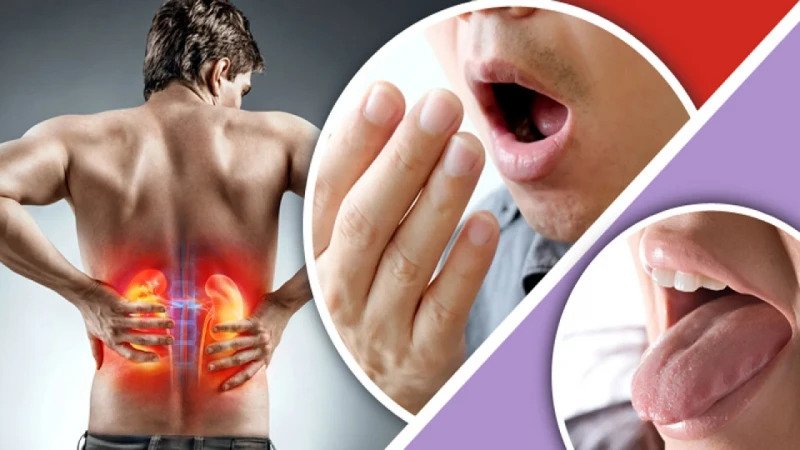 এই ৫ লক্ষণ দেখলেই বুঝবেন কি’ডনি ক্যান’সারে ভুগছেন!